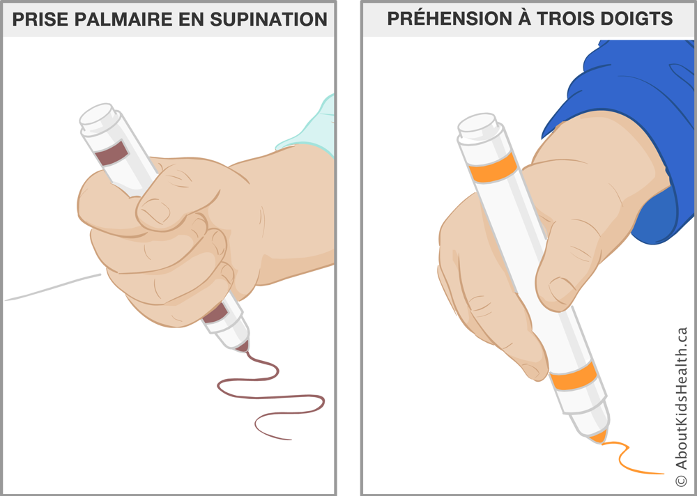Illustration de la prise palmaire en supination et la préhension à trois doigts d’un marqueur