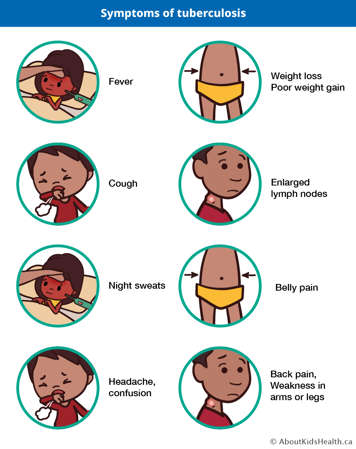 icons representing symptoms of tb: fever, cough, night sweats, headache, confusion, weight loss, poor weight gain, enlarged lymph nodes, belly pain, ack pain, weakness in arms or legs