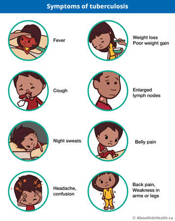 icons representing symptoms of tb: fever, cough, night sweats, headache, confusion, weight loss, poor weight gain, enlarged lymph nodes, belly pain, ack pain, weakness in arms or legs