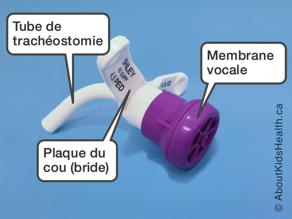 Identification du tube de trachéostomie, de la plaque du cou et de la membrane vocale