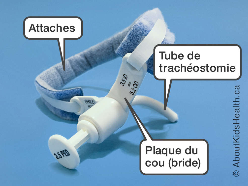 Les attaches qui se fixent au tube de trachéostomie par les plaques du cou