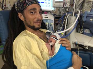 An infant with a breathing mask receiving kangaroo care