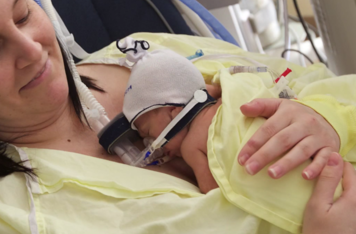 An infant with a breathing mask receiving kangaroo care