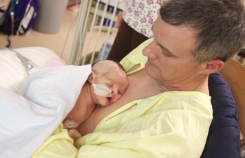 An infant with a breathing tube receiving kangaroo care