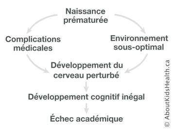 Graphique du trajet de la naissance prématurée à l’échec académique