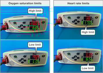A Masimo Rad-8 Oximeter showing where on the screen the high and low oxygen saturation limits are and where the high and low heart rate limits are