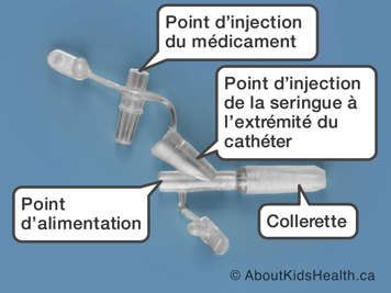 Les parties d’un adaptateur en Y Corport Corlock