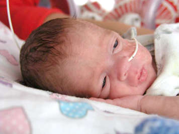 preemie with eyes open