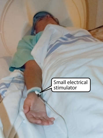 Small electrical stimulator on wrist of a child undergoing SEF test with their head in a MEG machine