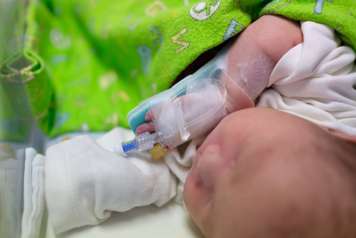 Baby with IV in back of hand and an IV splint holding it in place