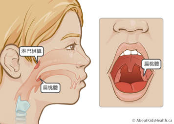 腺樣體和扁桃體位置示意