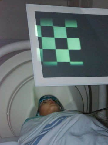 Child undergoing VEF test with their head in a MEG machine