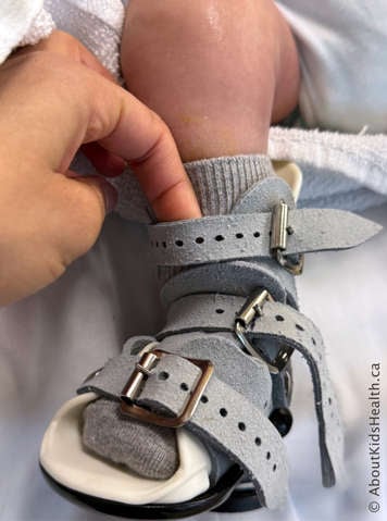 Checking the top strap to make sure you can fit a finger underneath