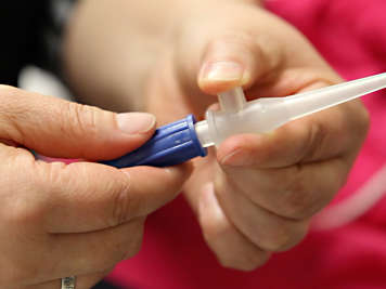 Pressing the thumb port on a tracheostomy suction tip adaptor.