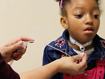 Holding thumb on a tracheostomy suction catheter suction control port