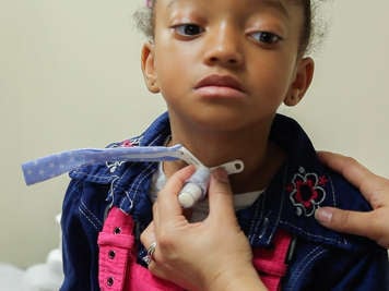 Holding tracheostomy tube in place while tracheostomy tube tie is loose.