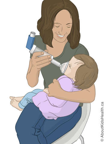An illustration of an adult is assisting a toddler with an asthma inhaler and spacer.