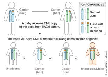 Chromosome distribution chart for a male and a female both carrying the beta thalassemia gene in one chromosome